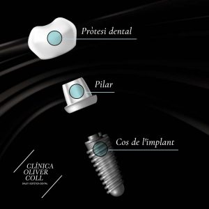 parts-implant-dental