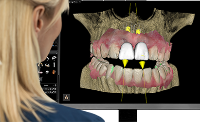 vista boca sistema cbct