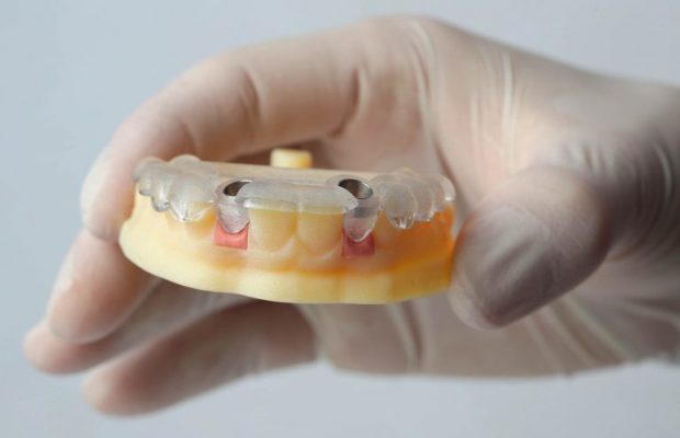 Férula implantes guiados, Oliver Coll