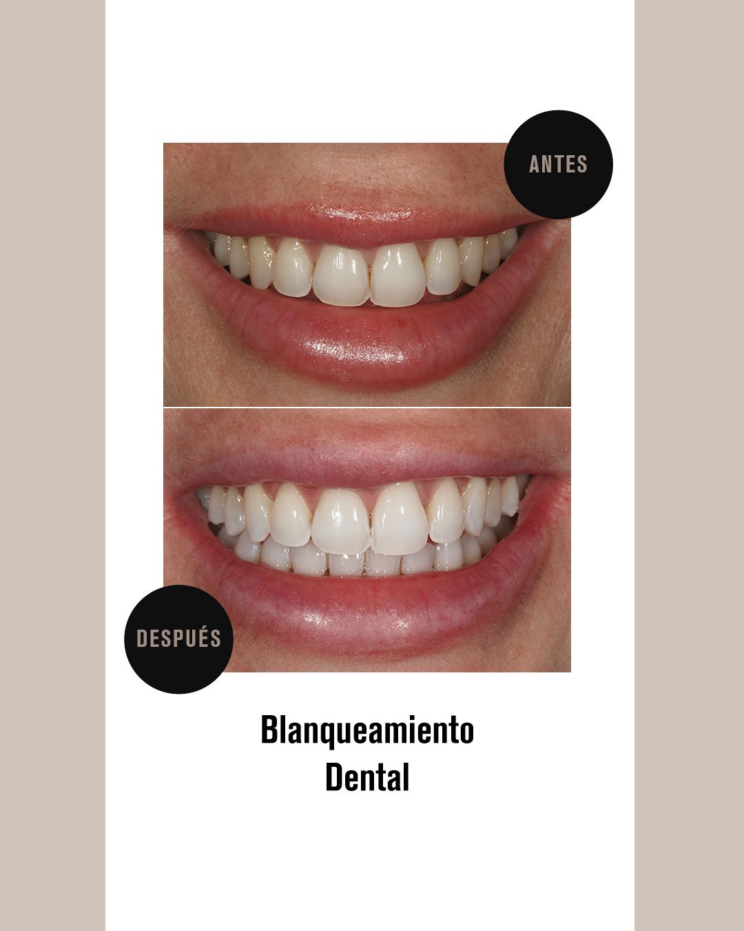 BLANQUEJAMENT 1