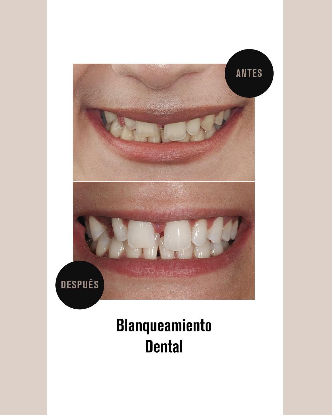 BLANQUEJAMENT 2