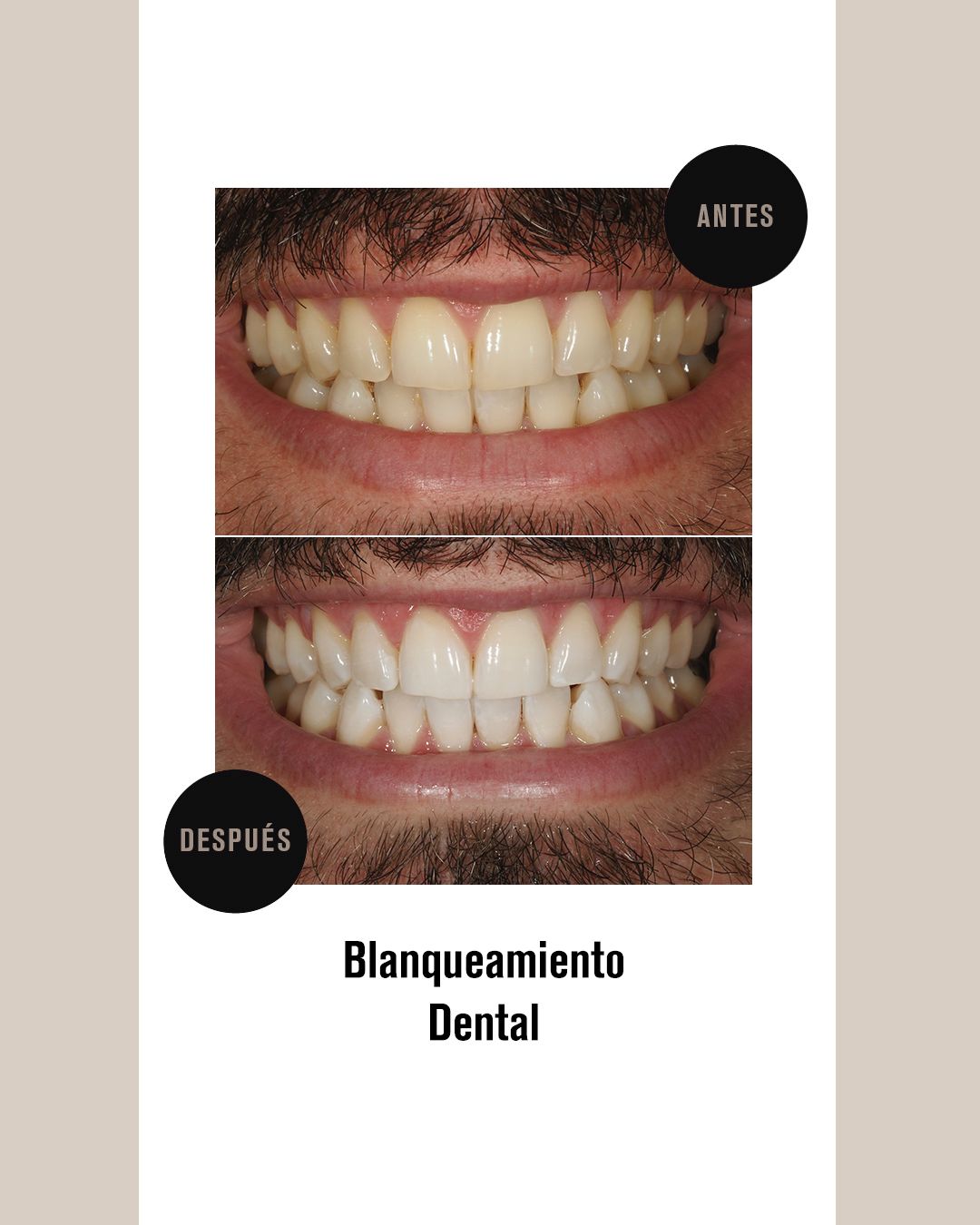 BLANQUEJAMENT 3