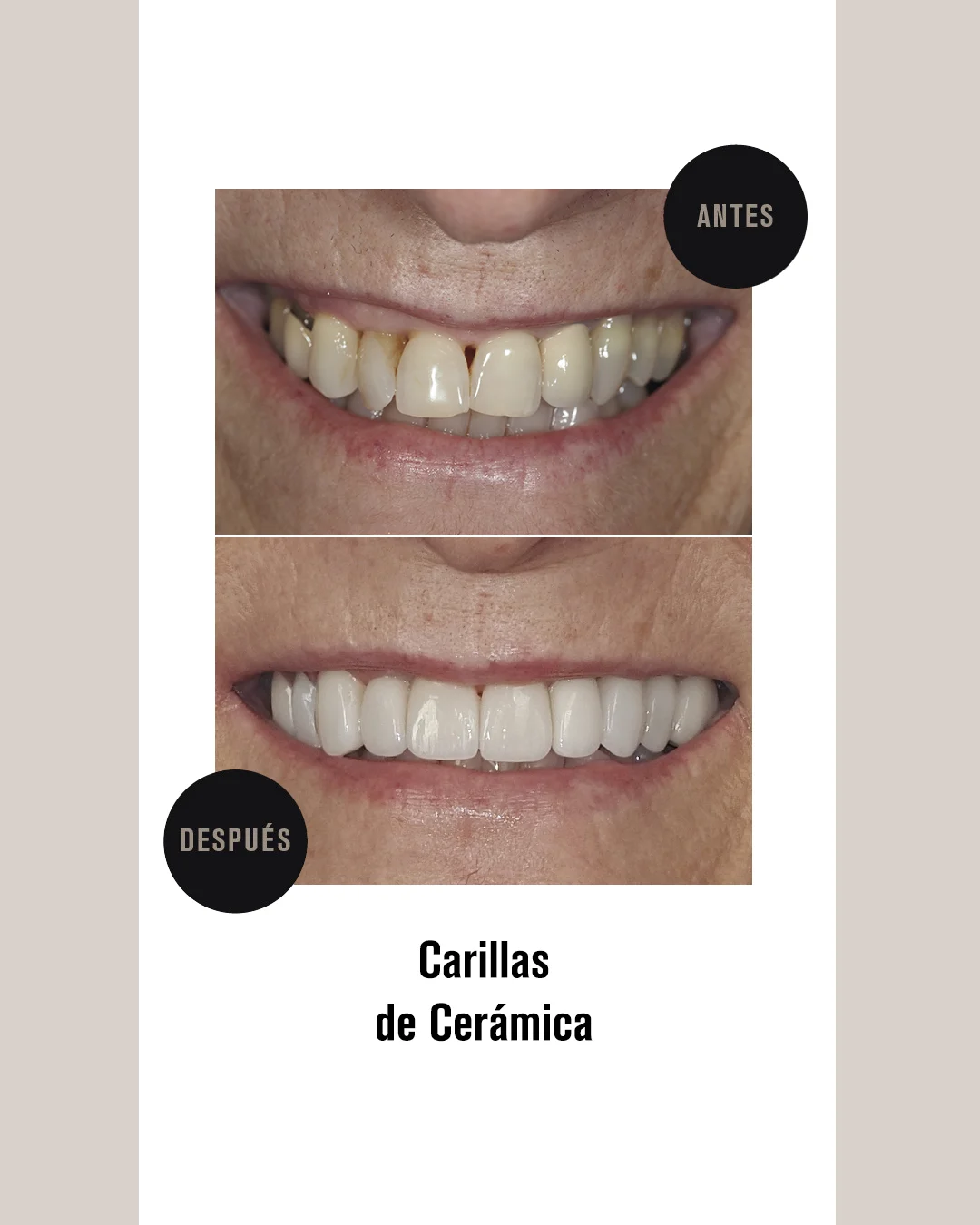 CARILLAS CERAMICA 4