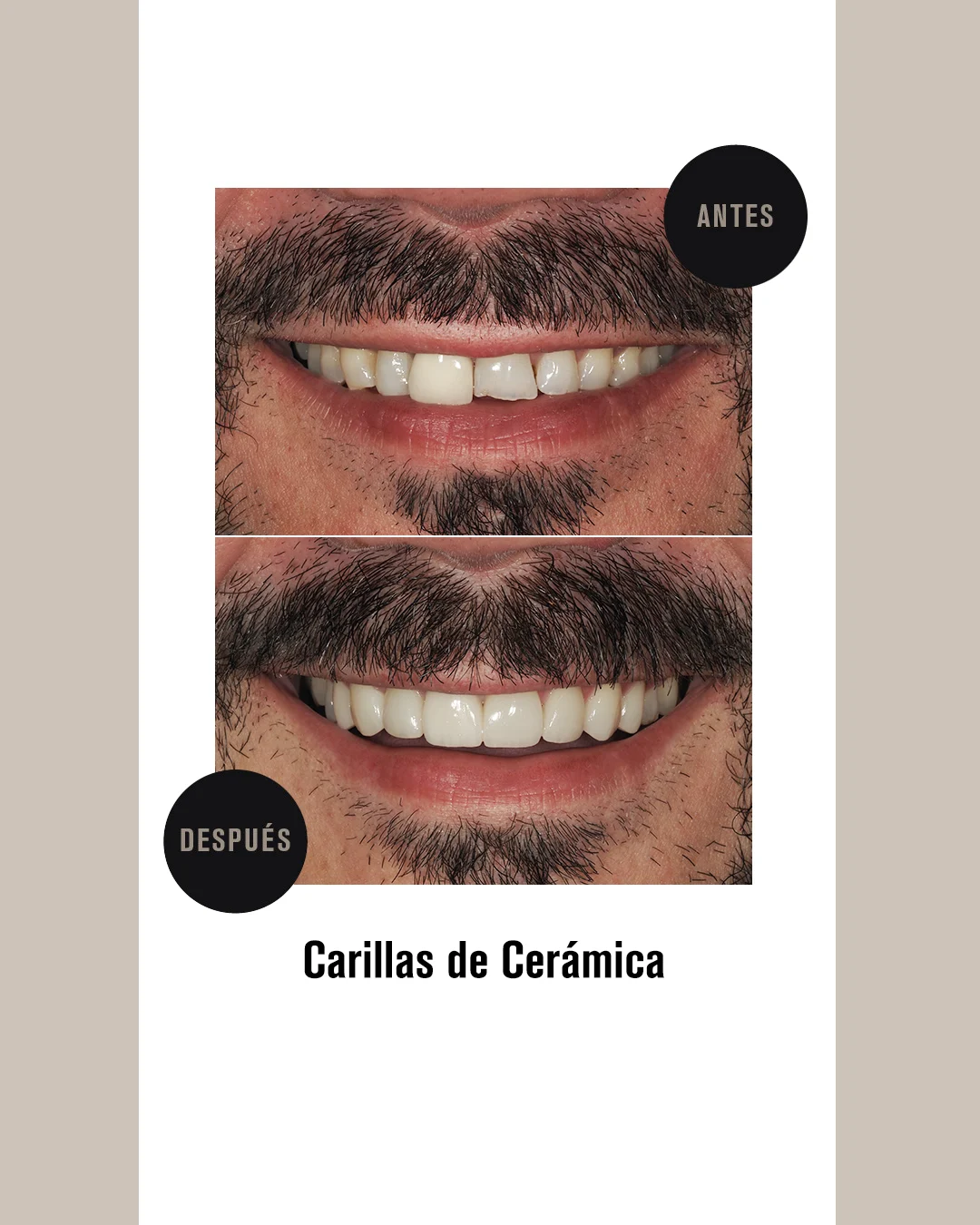 CARILLAS CERAMICA