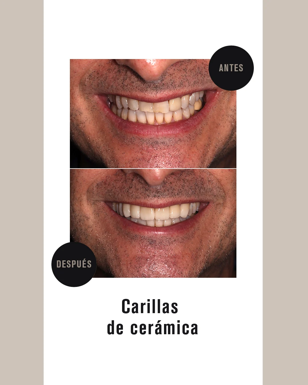 CARILLAS CERMICA 6