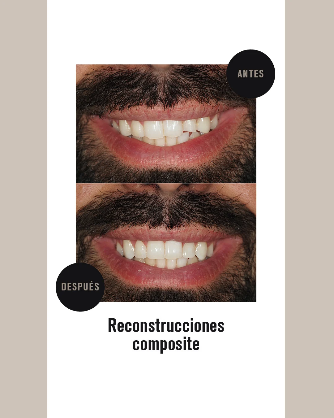 CARILLAS COMPOSITE