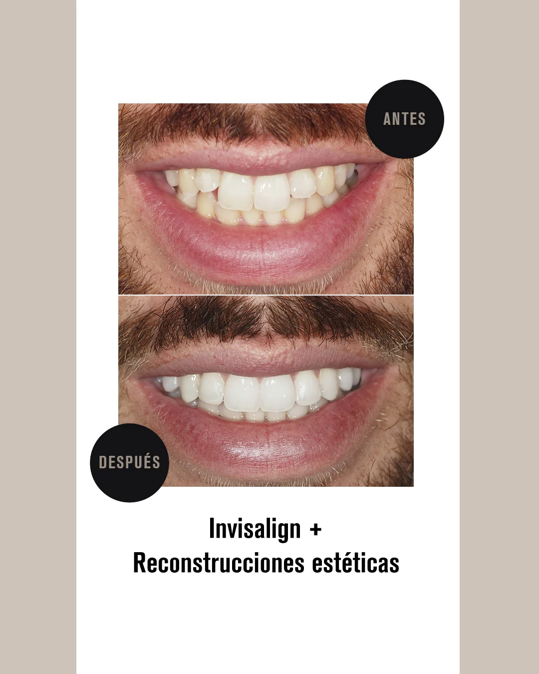 RECONSTRUCCIONES COMPOSITE (2)
